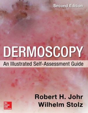 Dermoscopy An Illustrated Self-Assessment Guide 2nd 2E